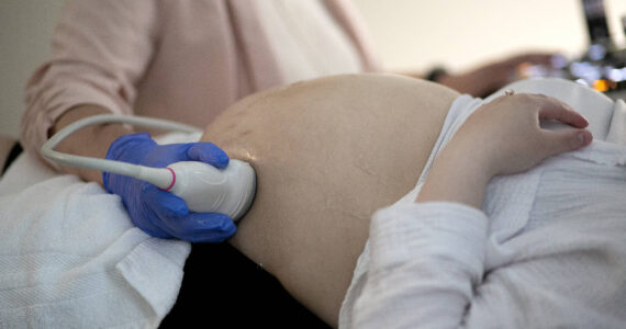 Sound Publishing file photo
An ultrasound being performed on an expecting mother in 2023 in Everett.